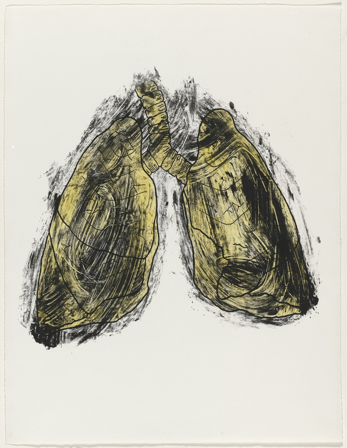 Kiki Smith. Lungs from Possession Is Nine-Tenths of the Law. 1985