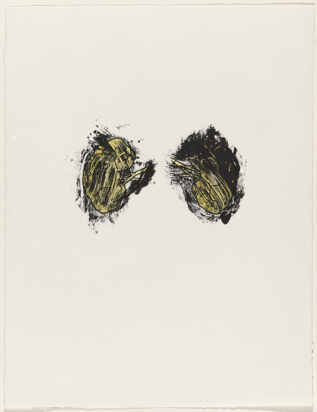 Kiki Smith. Kidneys from Possession Is Nine-Tenths of the Law. 1985