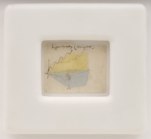 HYPERTROPHY (incline)