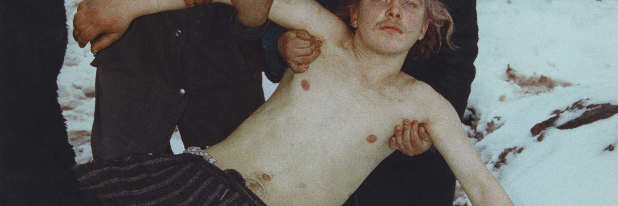 Boris Mikhailov. Untitled, from the series Case History. 1997–98. Chromogenic color print. 58 7/16 x 39 3/16&#34; (148.5 x 99.5 cm). The Museum of Modern Art. Acquired through the generosity of Howard Stein. © 2011 Boris Mikhailov