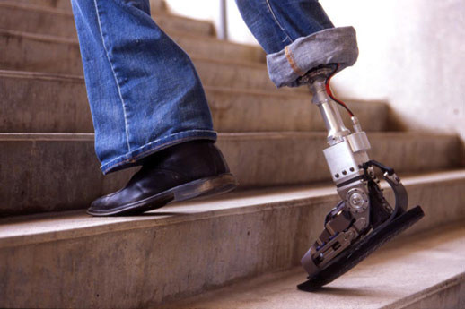 Hugh Herr, Jeff Weber, and Bruce Deffenbaugh
Biomechatronics Group, Massachusetts Institute of Technology
iWalk, Inc.
Powered Ankle-Foot Prosthesis. Prototype. 2005–07