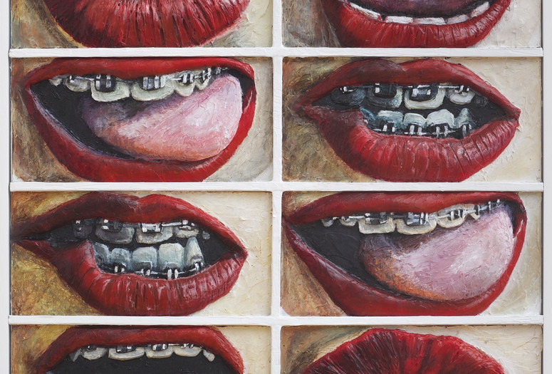 Gina Beavers. Who Has Braces. 2014. Acrylic and wood on canvas panel. Courtesy of the artist.