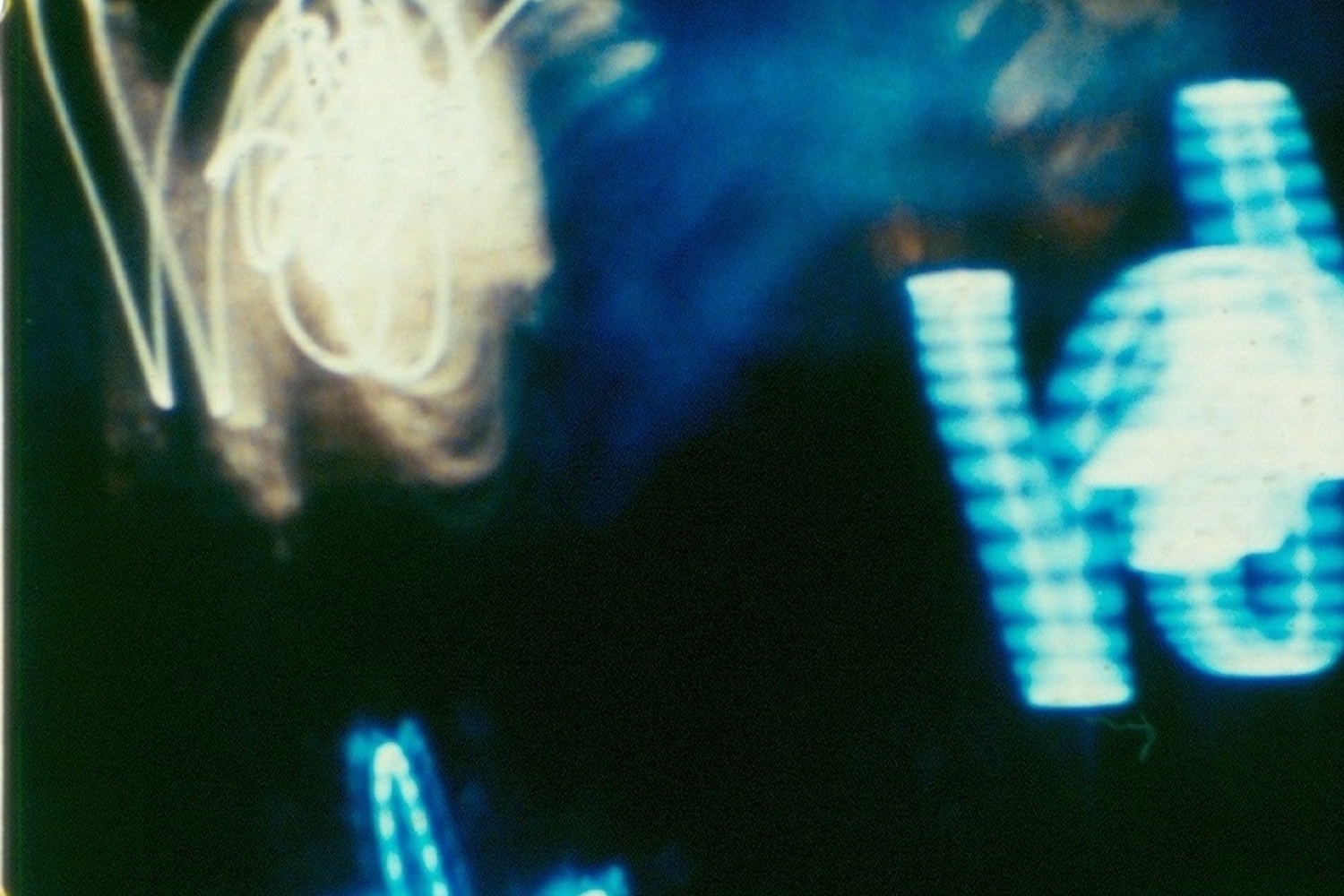 The Thatch of Night. 1990. USA. Directed by Stan Brakhage. Courtesy the Estate of Stan Brakhage and Fred Camper