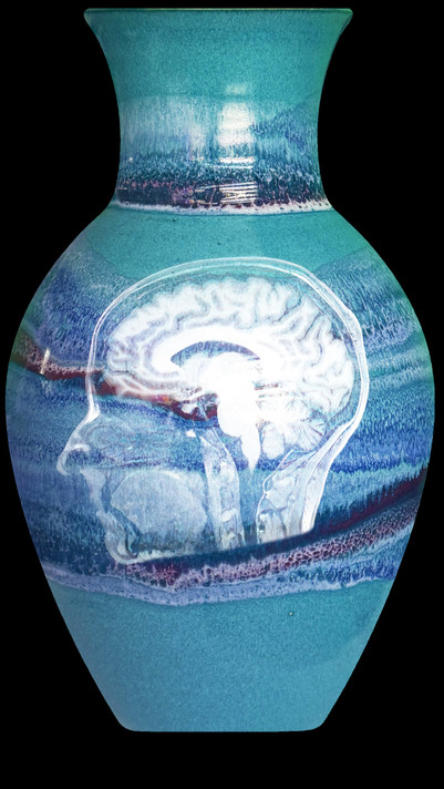 Shana Moulton. Still from Meta/Physical Therapy. 2023–24