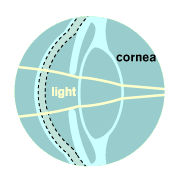 cornea