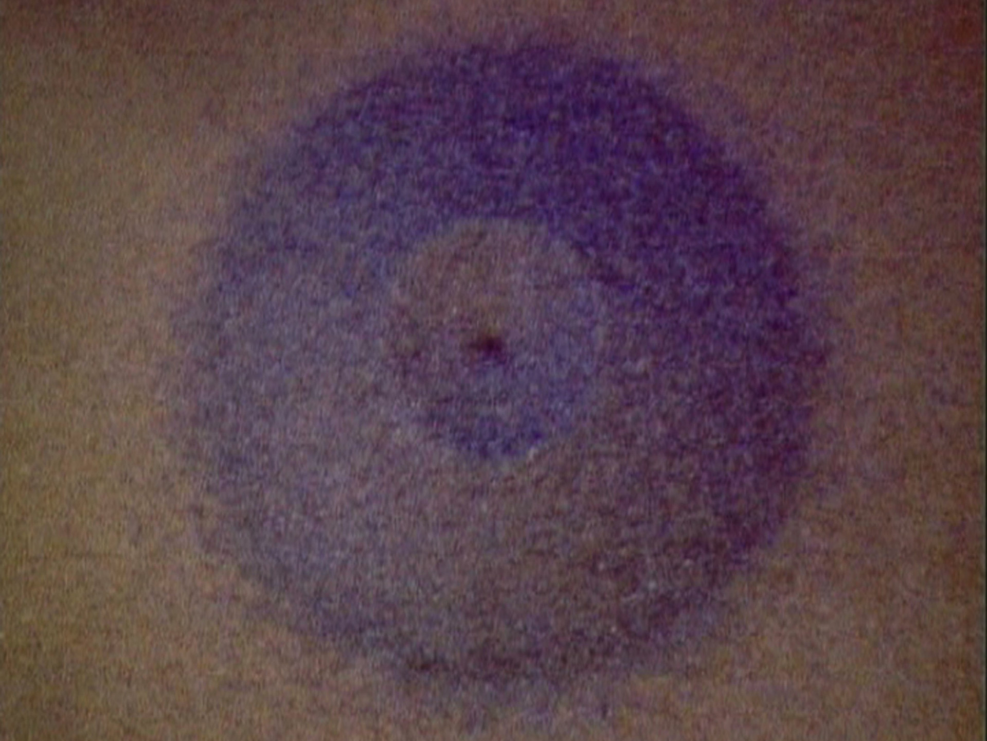 Roman Signer. Crater. 1980
