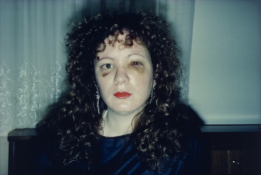 Nan Goldin. Nan One Month After Being Battered. 1984 | MoMA