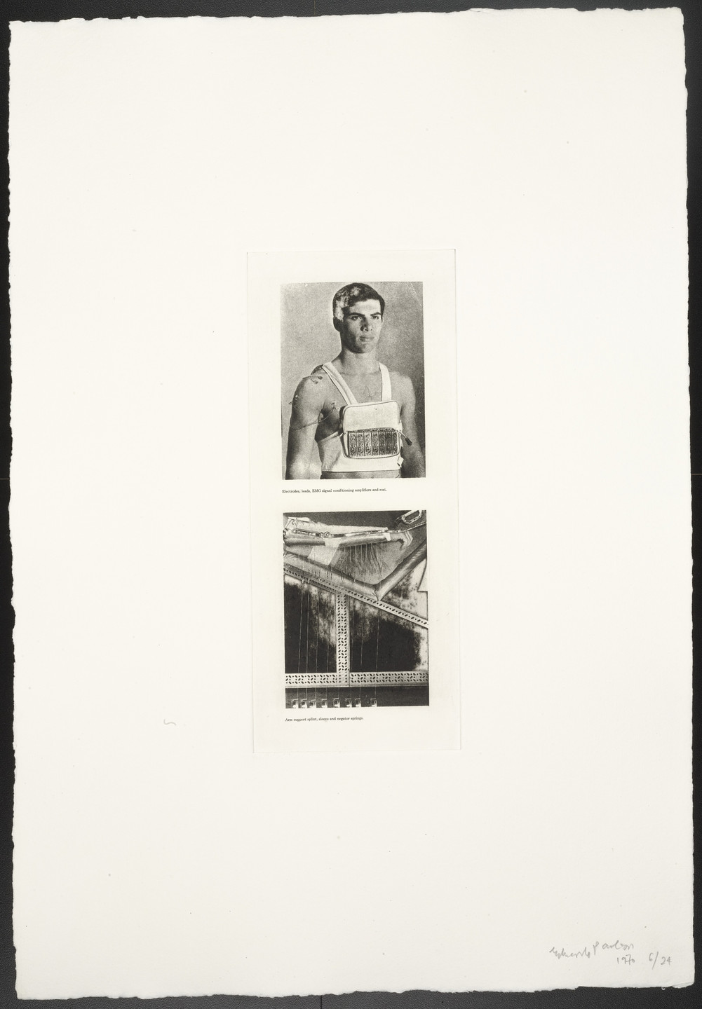 Eduardo Paolozzi. Electrodes, Etc. Arm Support, Etc. from The Conditional Probability Machine. 1970