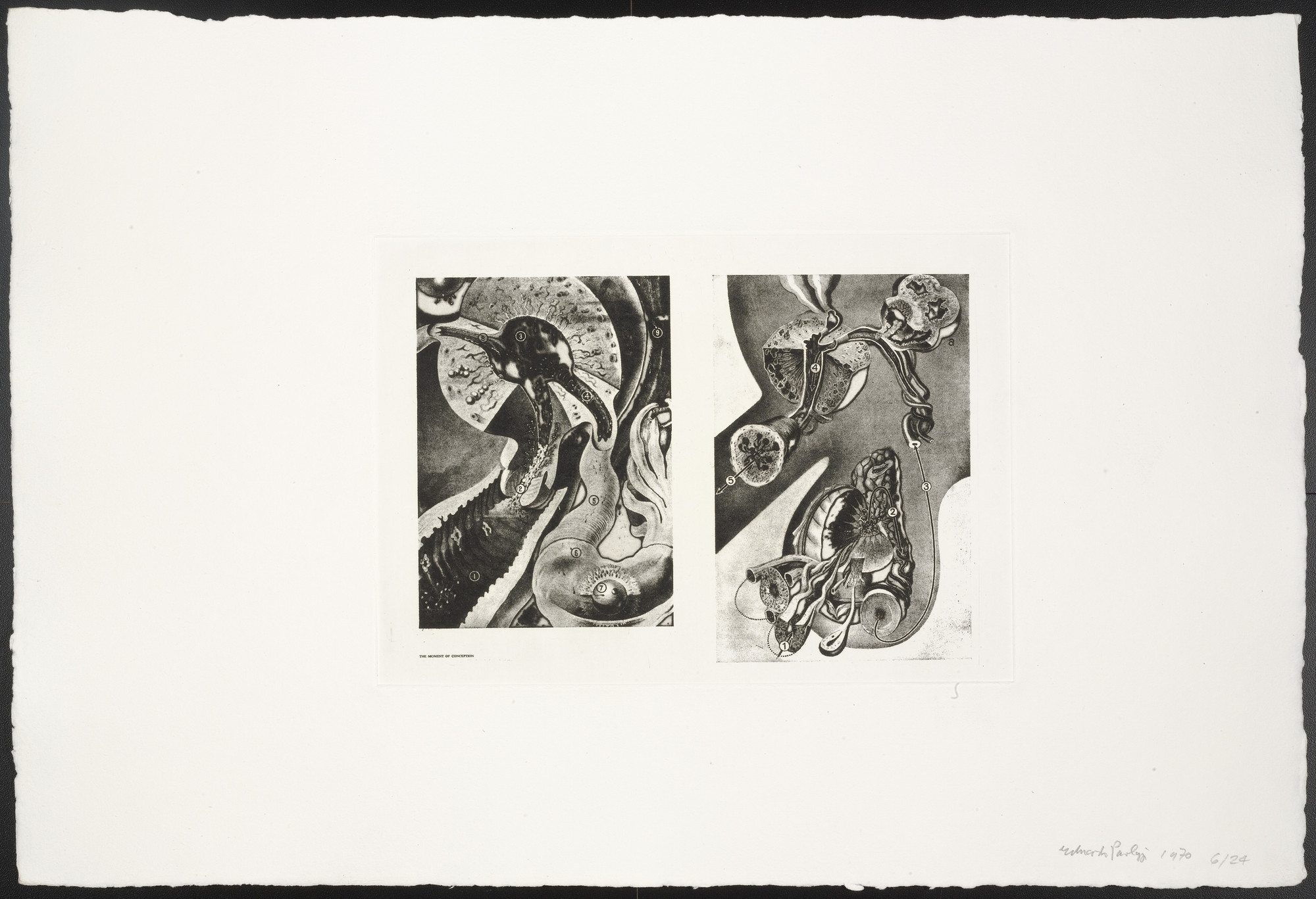 Eduardo Paolozzi. The Moment of Conception from The Conditional Probability Machine. 1970