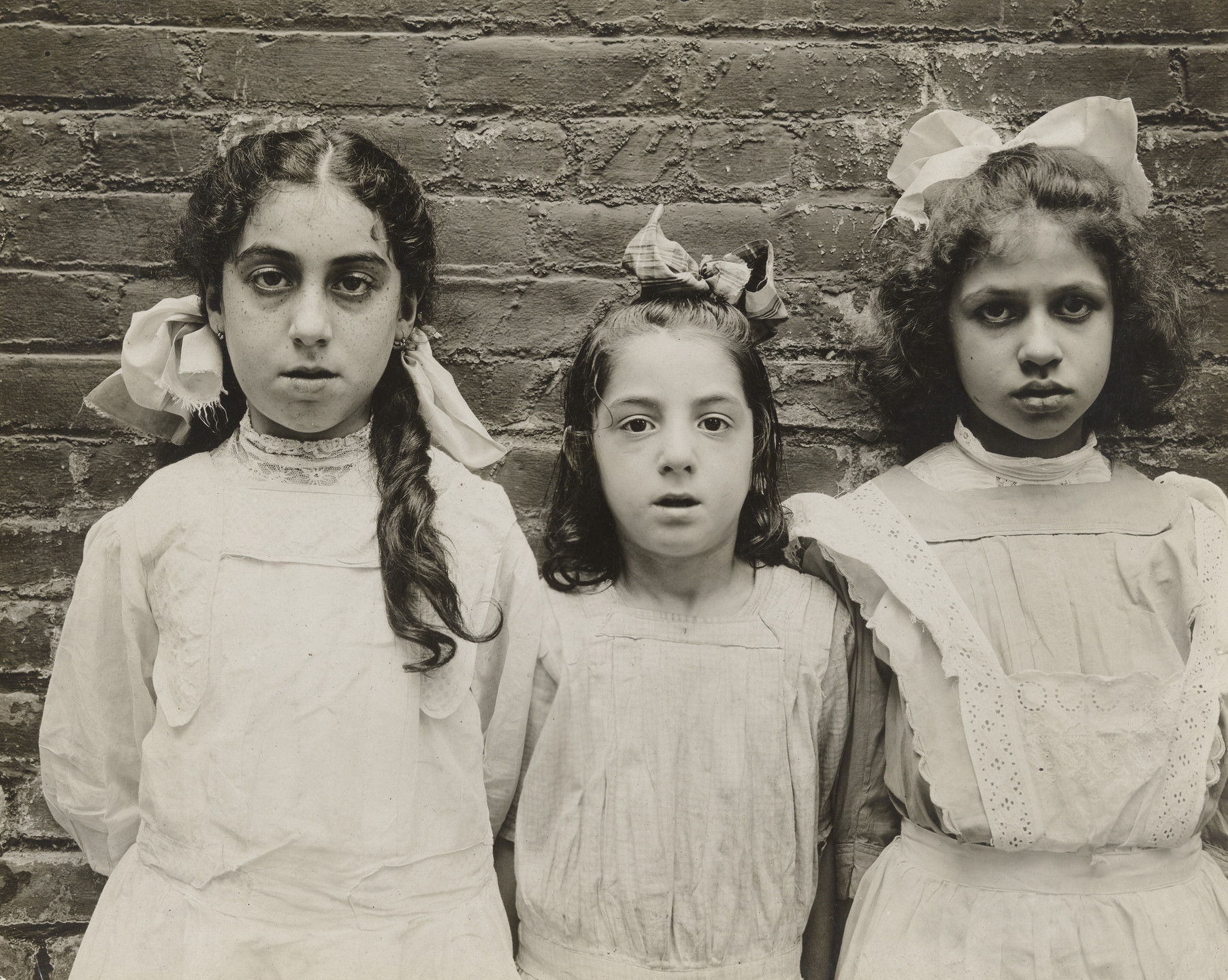 Jessie Tarbox Beals. Physically Defective Children. c. 1910