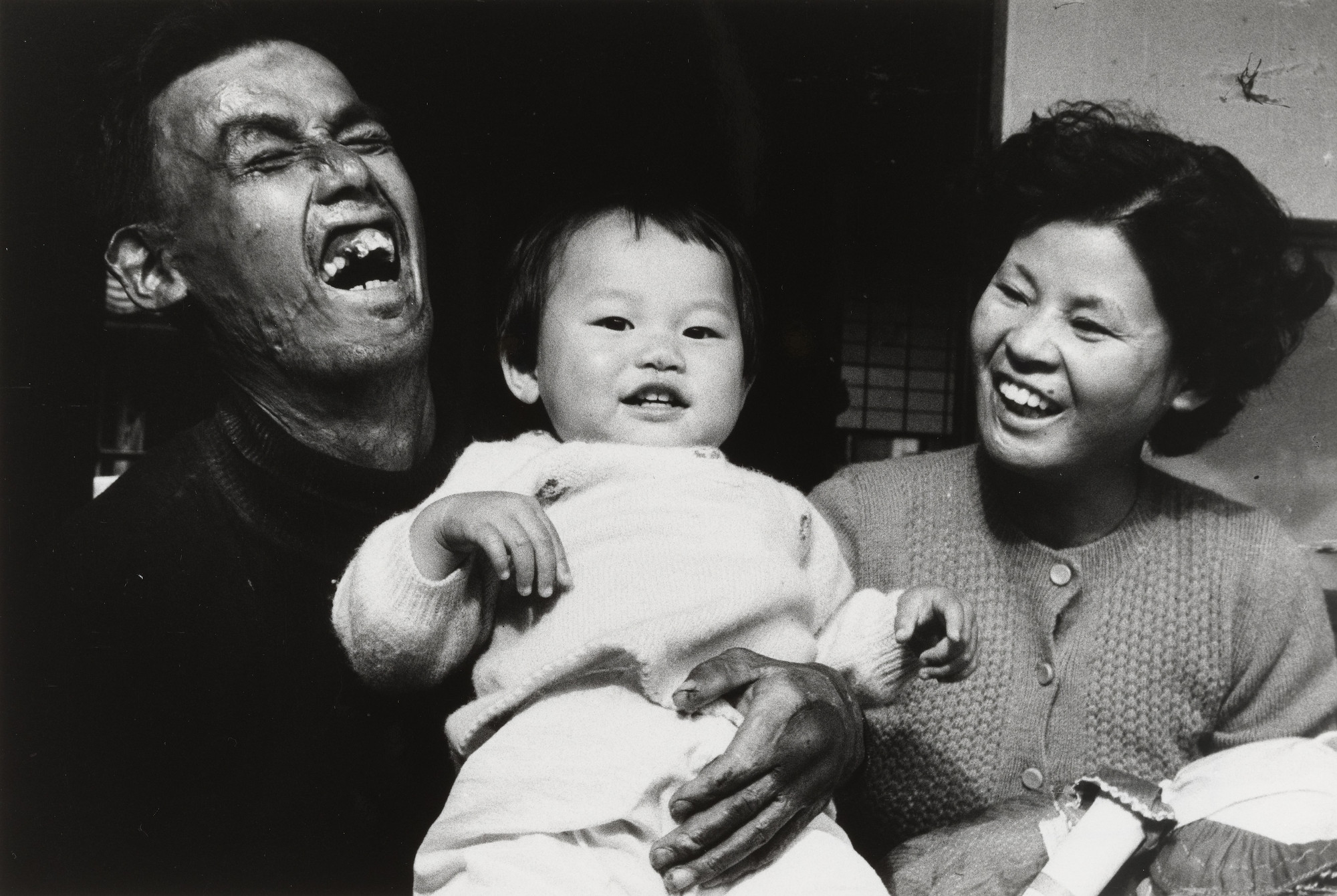 Ken Domon. Mr. and Mrs. Kotani: Two Who Have Suffered from the Bomb