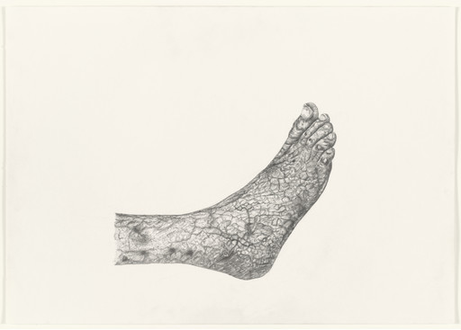 Claudication
