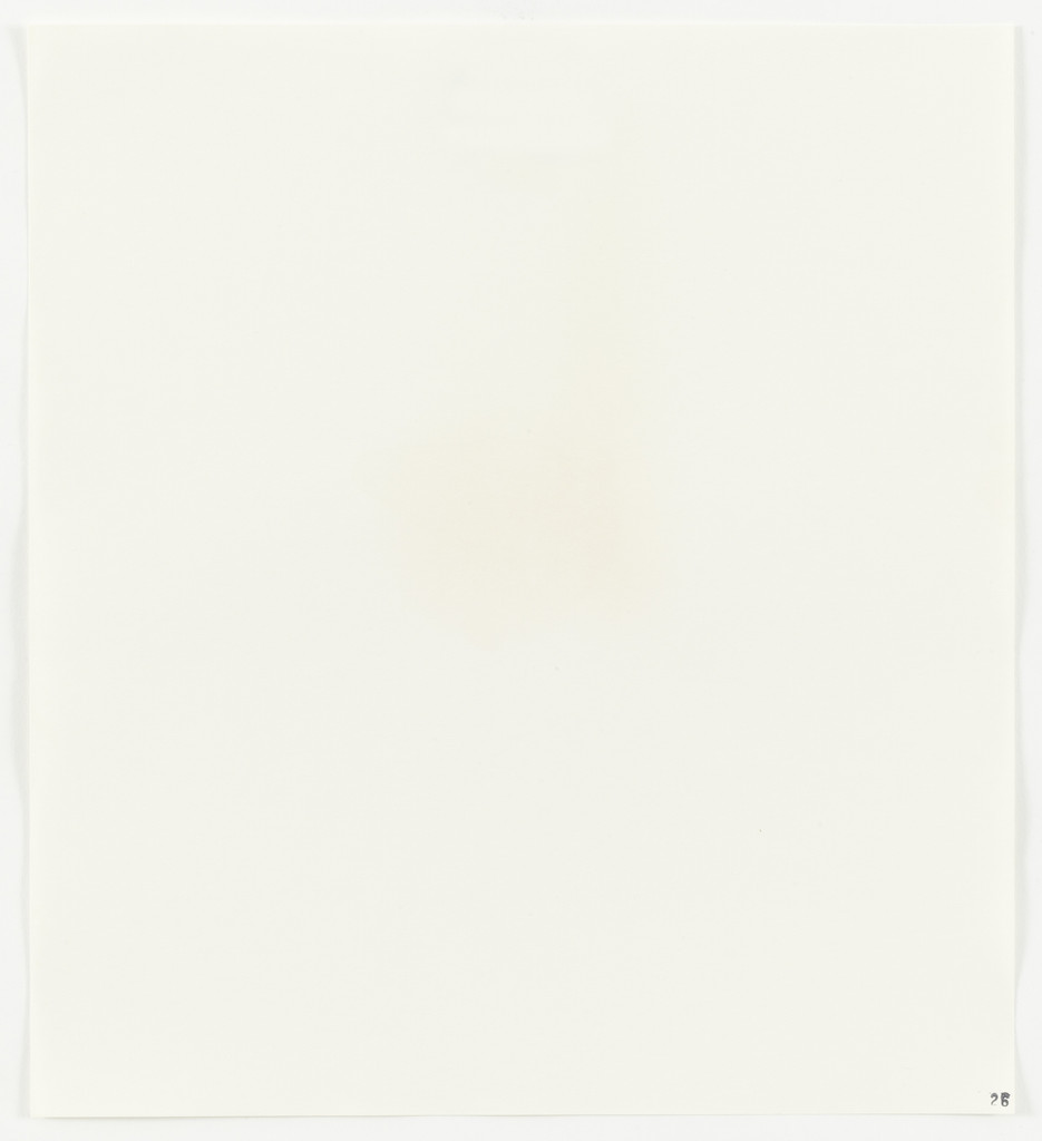 Glacial Acetic Acid (Robinson) from Stains