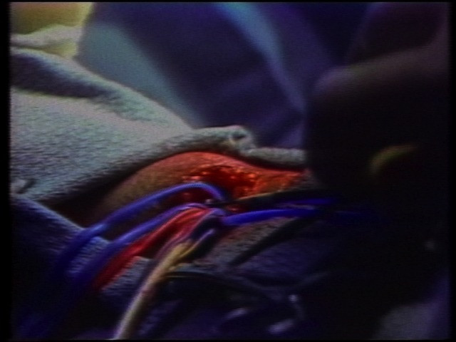 Close-up