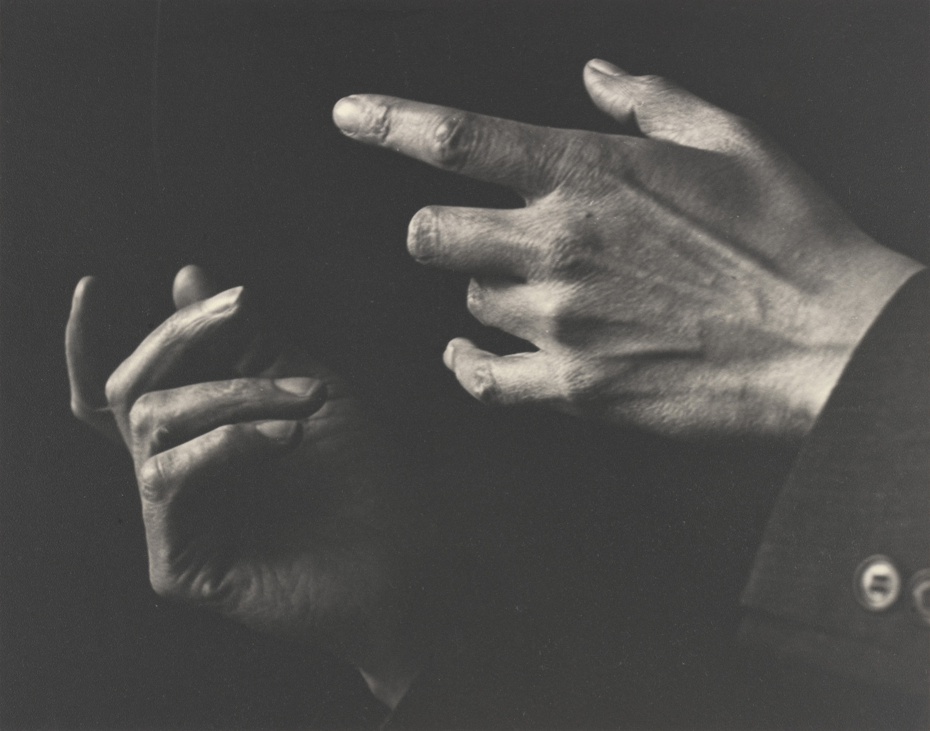 Two hands with fingers extended against a dark background are prominently displayed. The image is in black and white, with detailed textures and shadows on the hands. This is an AI generated description. To give feedback, email ai@moma.org.