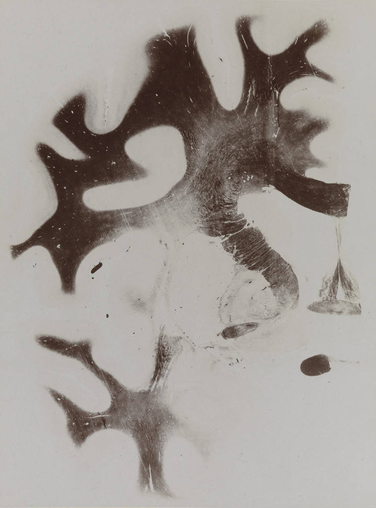 Map of the Brain: Cross-Section I, Frontal Section Plate 11 from an album published by The Psychiatric Clinic of Breslau