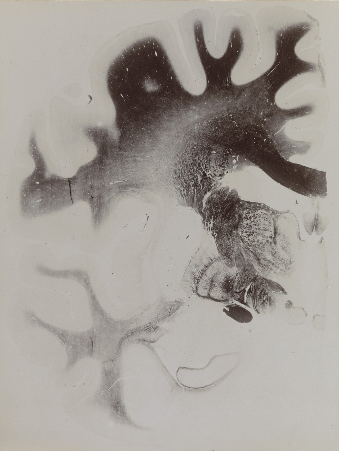 Unidentified photographer. Map of the Brain: Cross-Section I, Frontal Section Plate 13 from an album published by The Psychiatric Clinic of Breslau. c. 1915