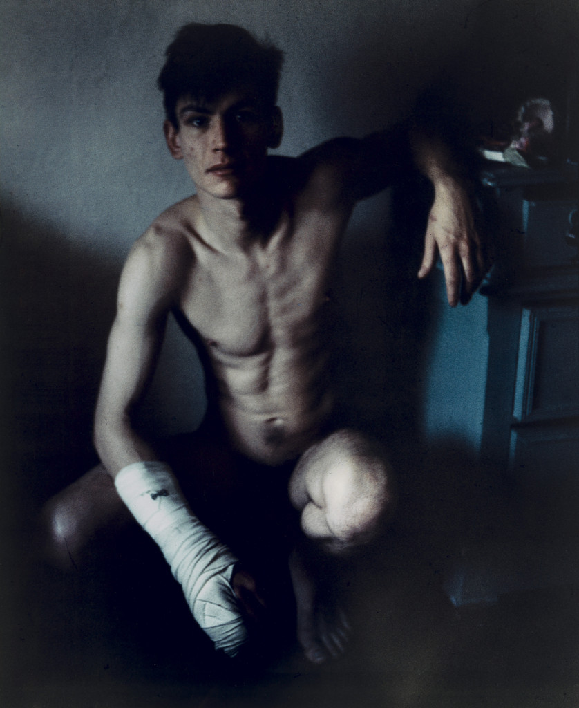 Self-Portrait with Broken Finger, Christmas