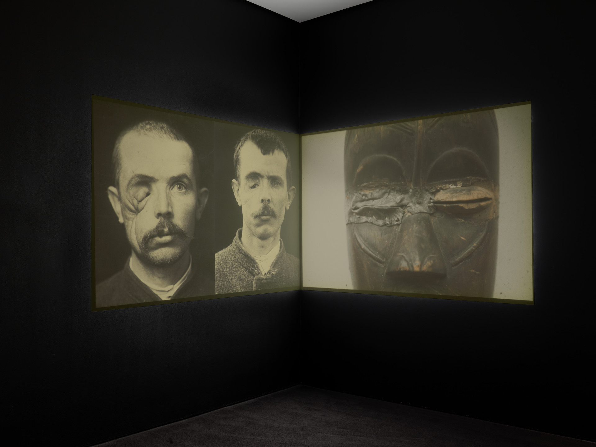 Kader Attia. Open Your Eyes. 2010