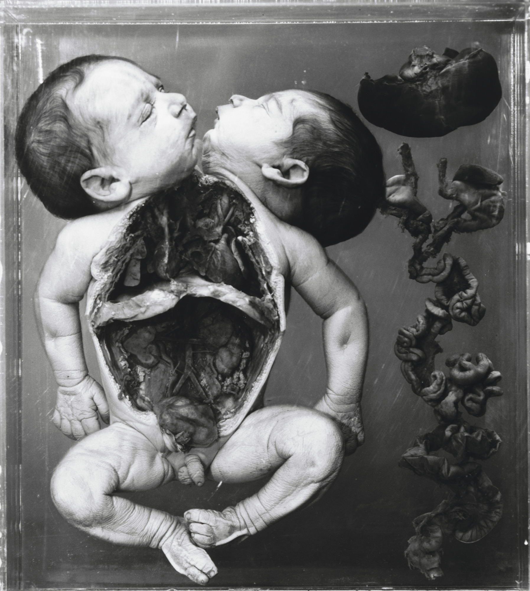 Diana Michener. Anadidymus
