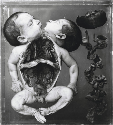 Anadidymus