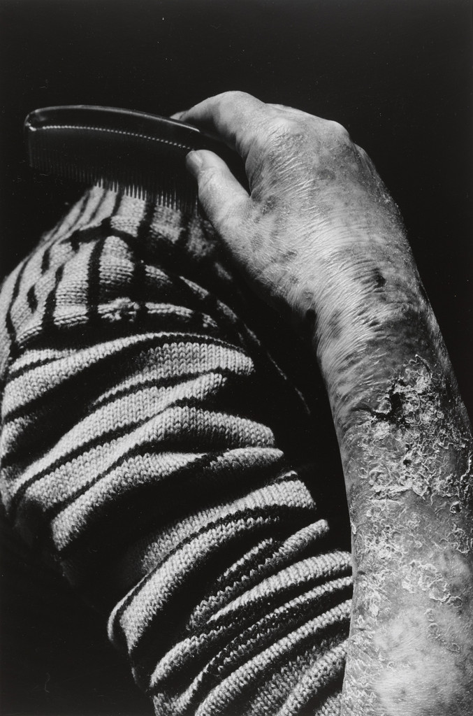 Hibakusha Fukuda Sumako, Nagasaki