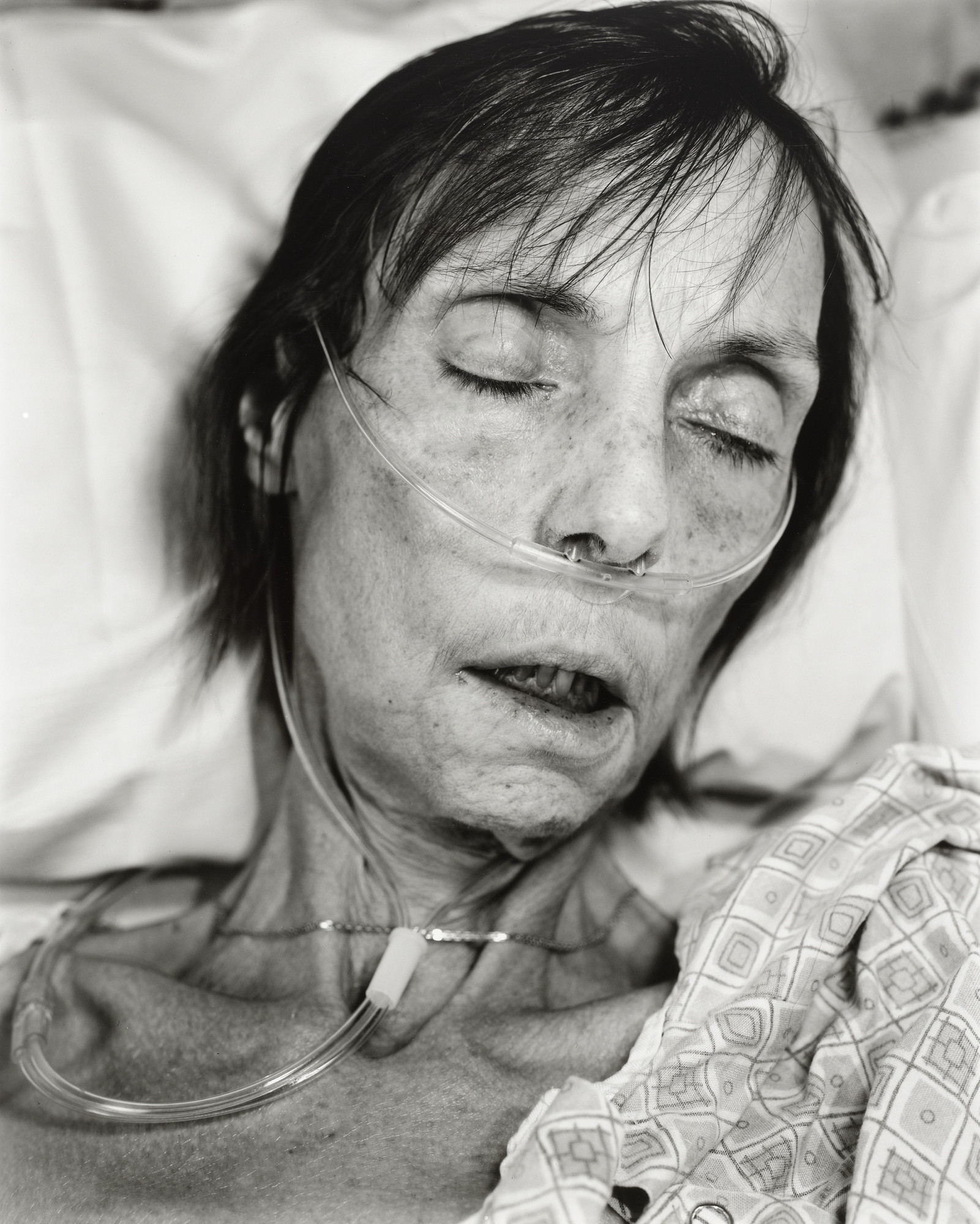 Nicholas Nixon. Susanne Richardson, Boston, Massachusetts