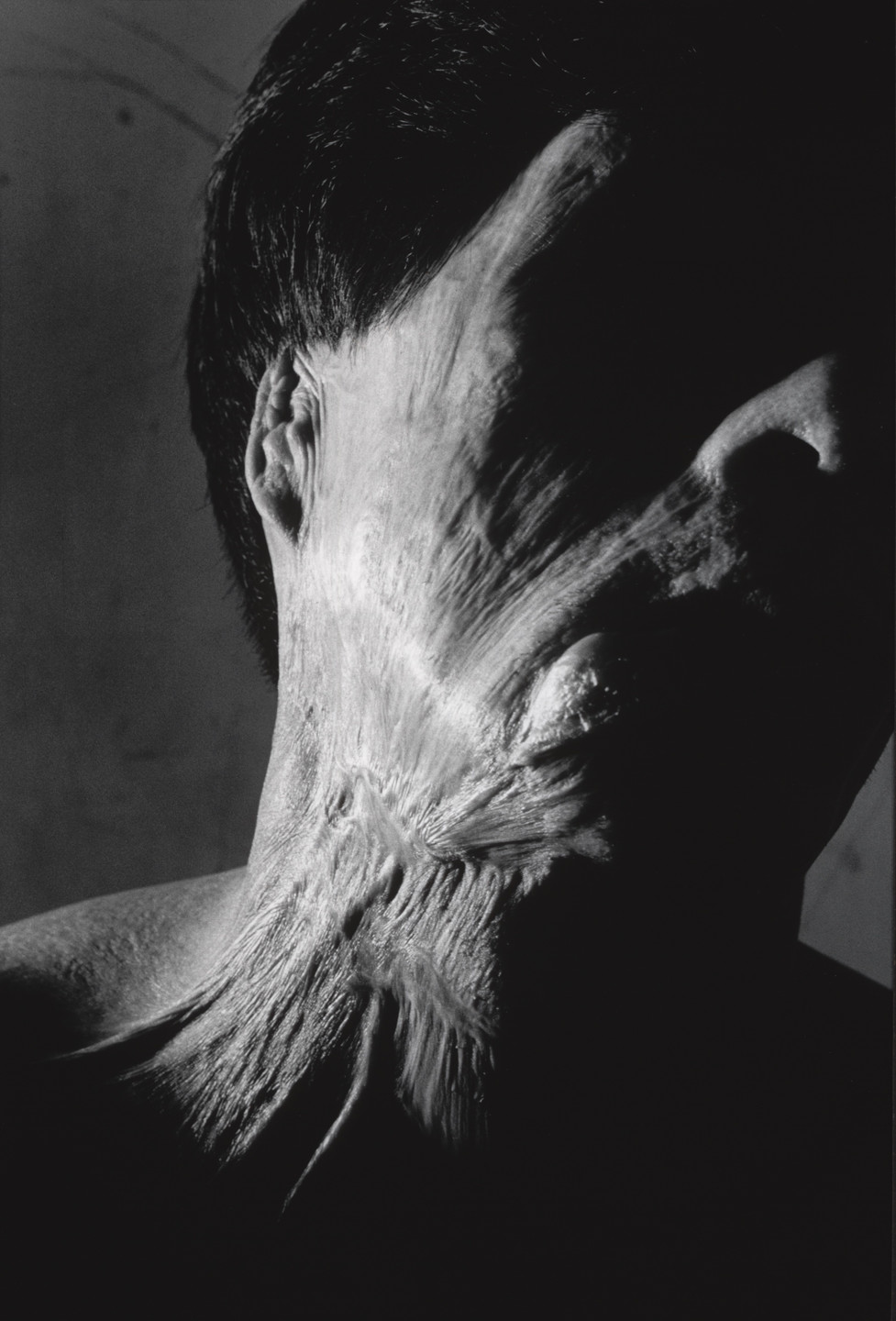 Shomei Tomatsu. Hibakusha Senji Yamaguchi, Nagasaki. 1962