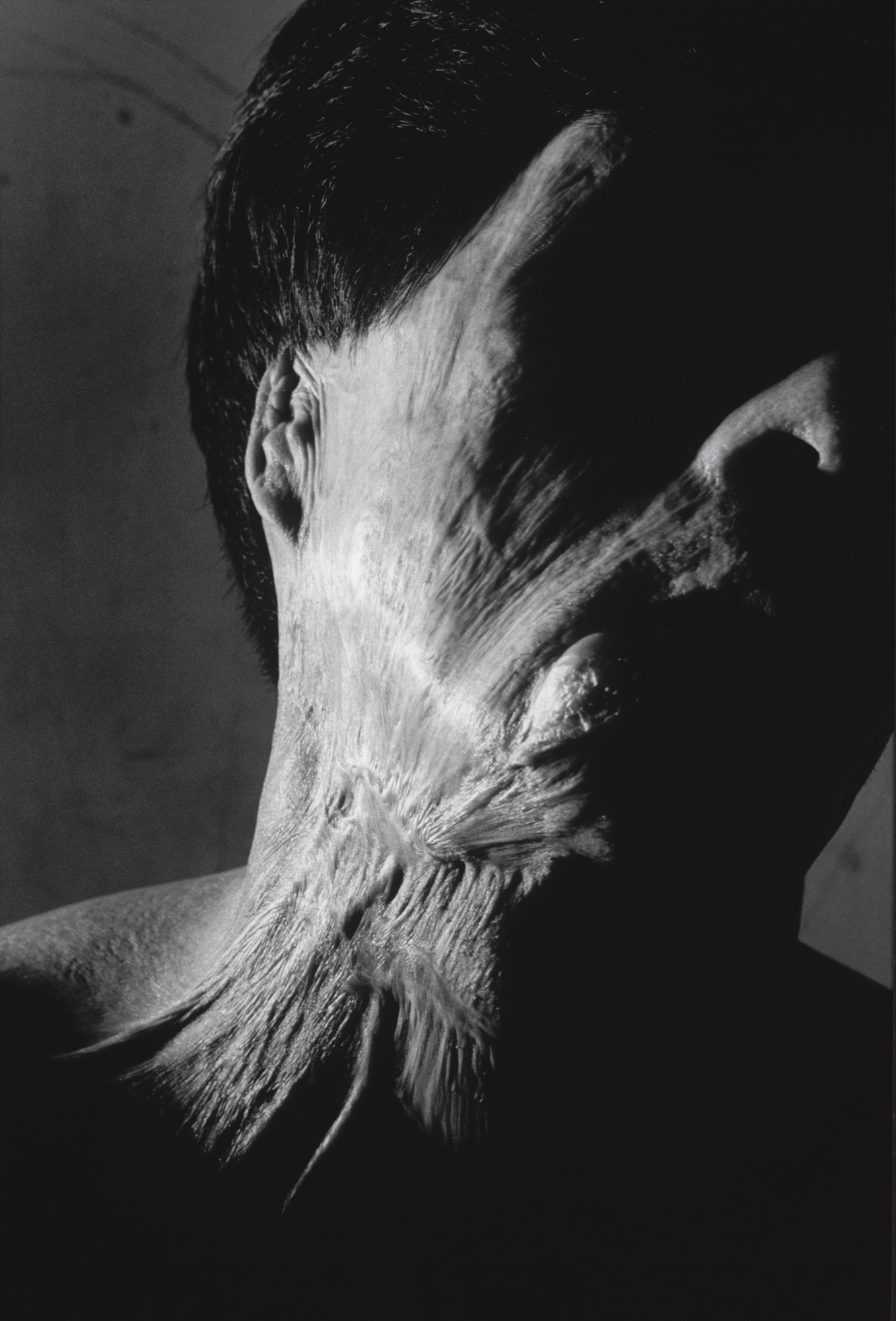 Shomei Tomatsu. Hibakusha Senji Yamaguchi, Nagasaki. 1962 | MoMA