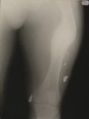 Unidentified photographer. X-Ray. 1917