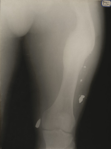 Unidentified photographer. X-Ray. 1917
