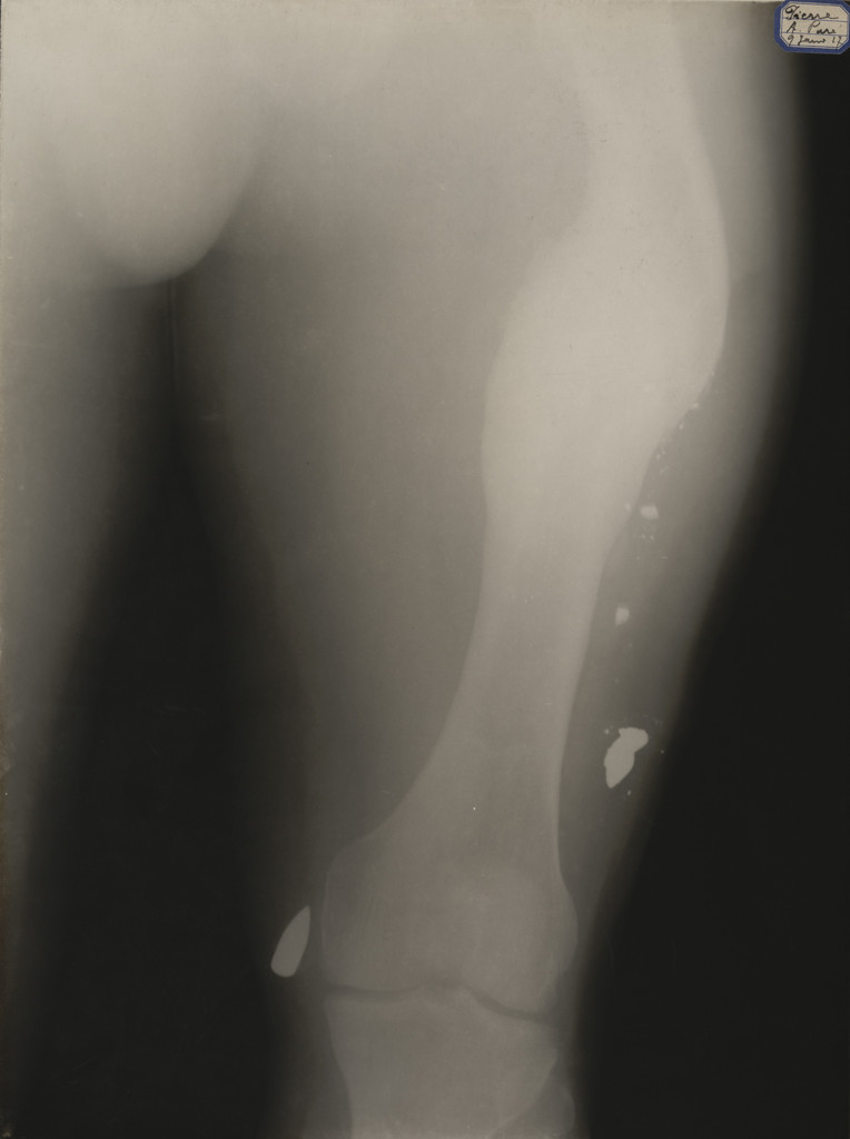 X-Ray