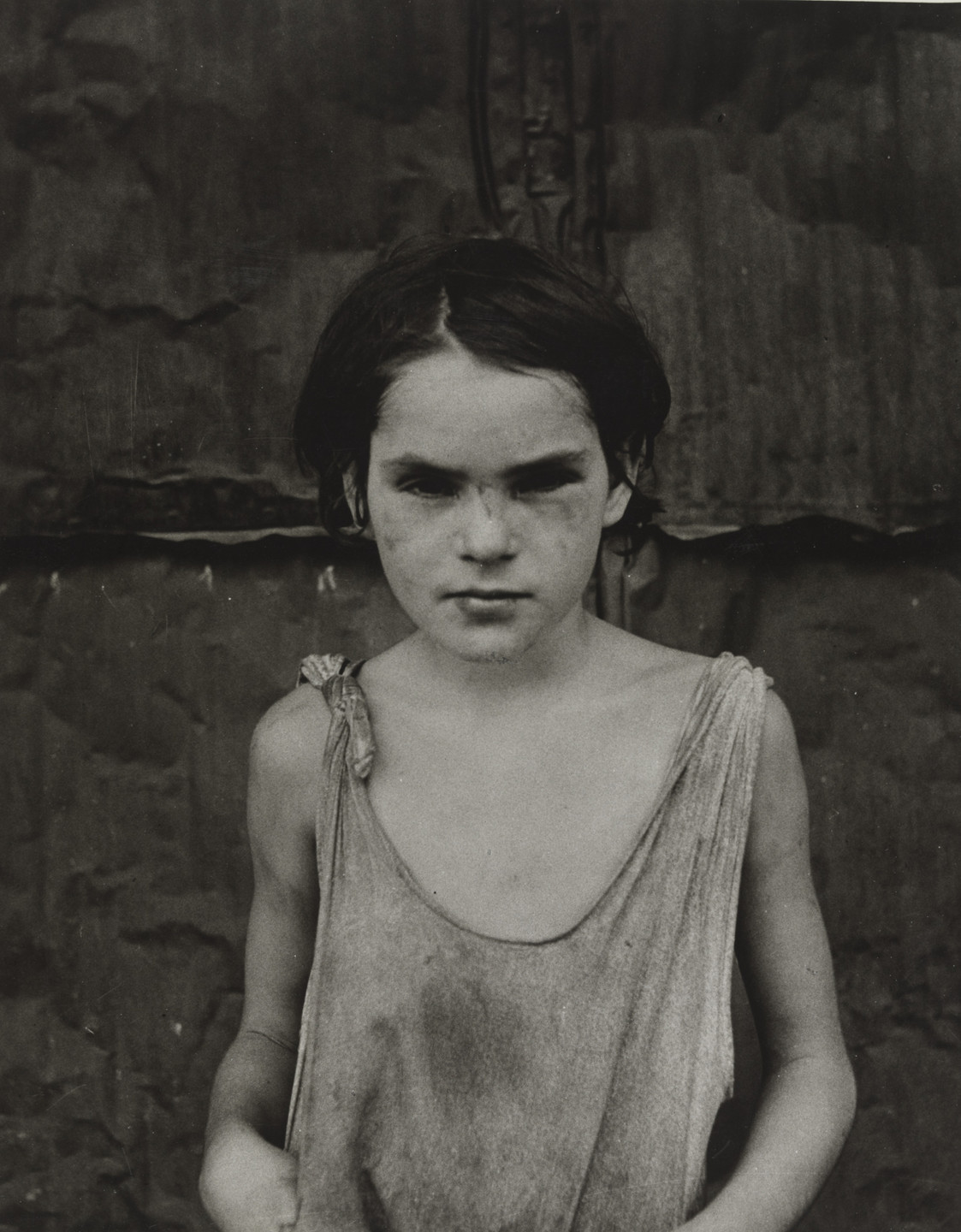 Dorothea Lange. Damaged Child, Shacktown, Elm Grove, Oklahoma. August 1936