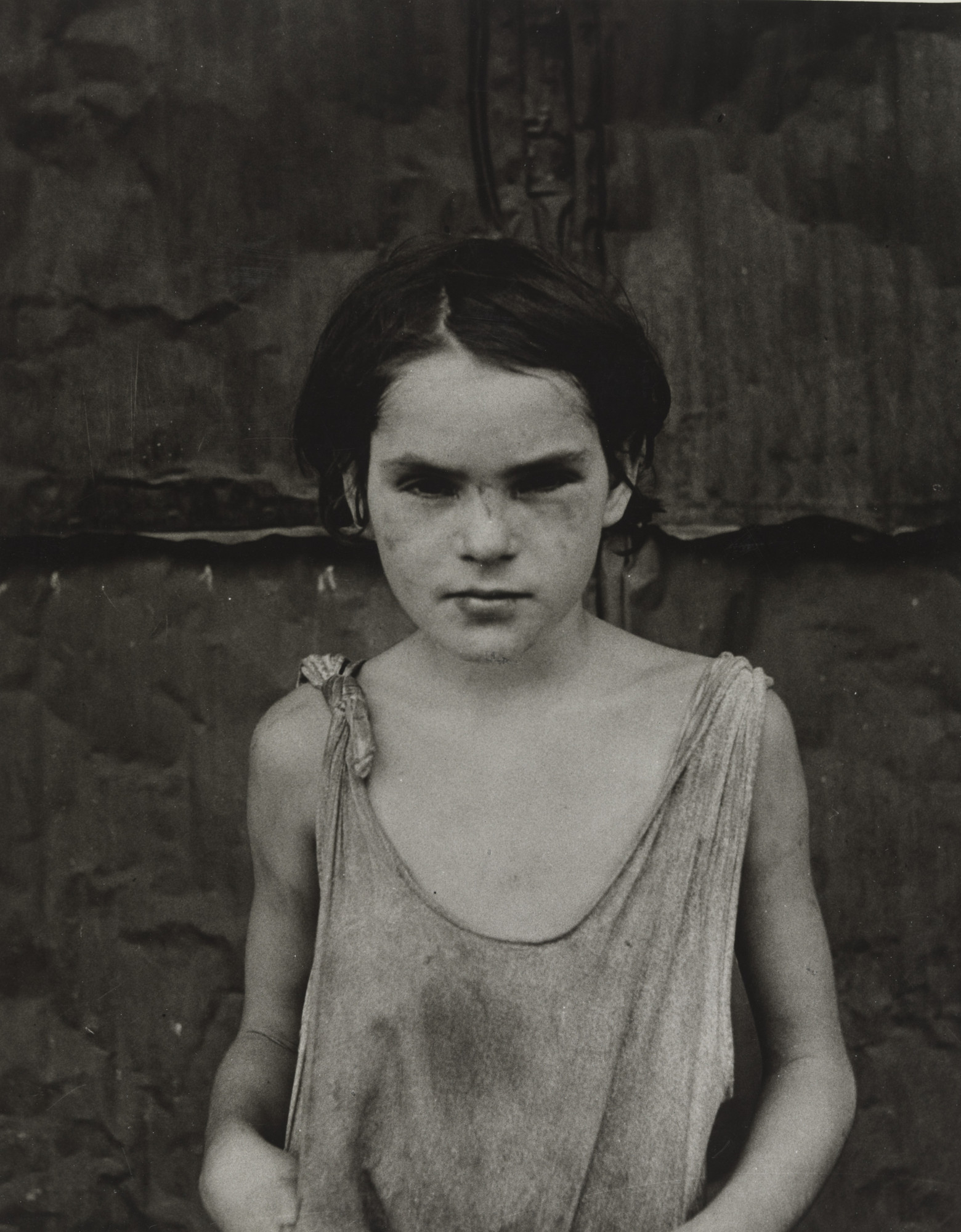 Dorothea Lange Damaged Child Shacktown Elm Grove Oklahoma August 1936 Moma