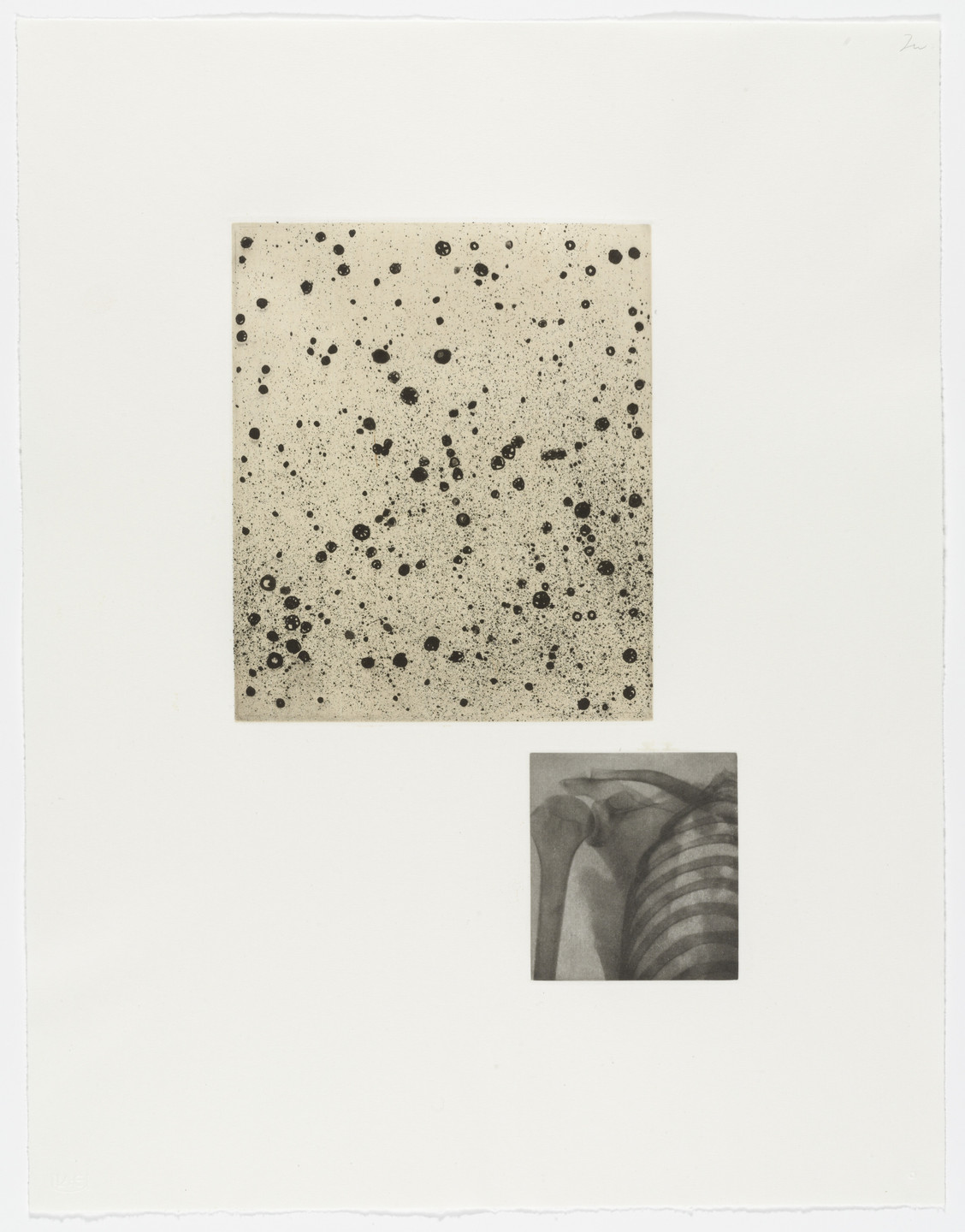 Terry Winters. Fourteen Etchings 6. 1989