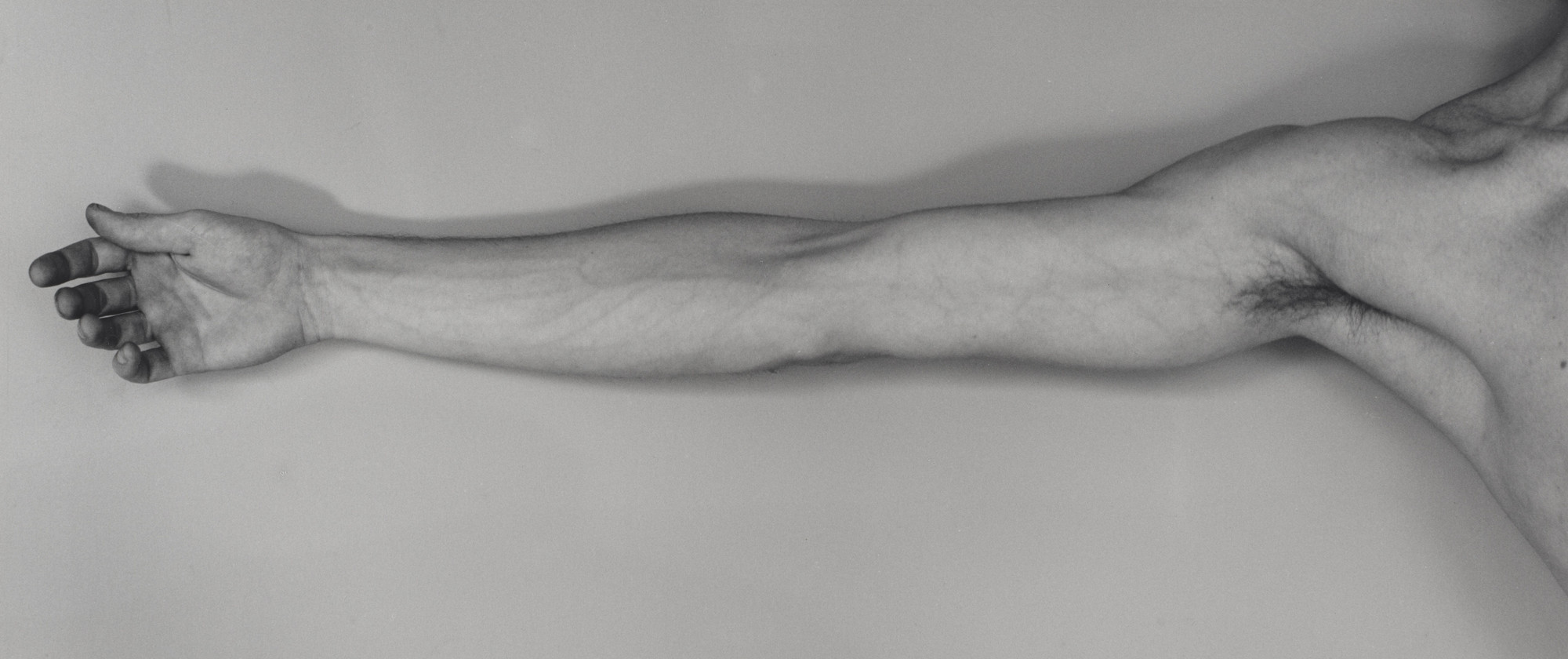 Robert Mapplethorpe. Arm (Self-Portrait). 1976