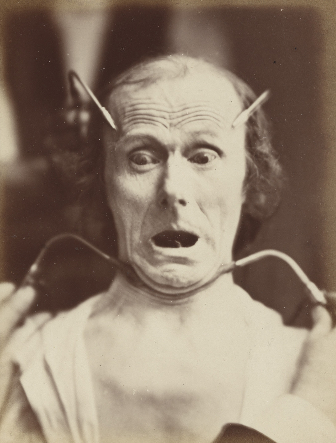 Guillaume-Benjamin-Armand Duchenne de Boulogne, Adrien Tournachon. Fright, from Mechanics of Human Physiognomy. 1855-56