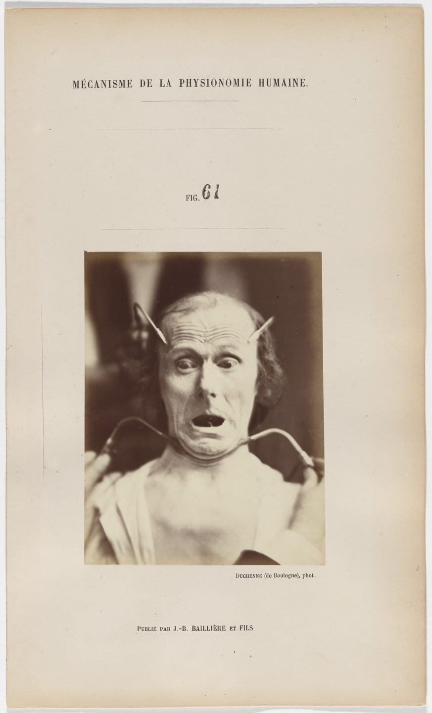 Guillaume-Benjamin-Armand Duchenne de Boulogne, Adrien Tournachon. Fright, from Mechanics of Human Physiognomy. 1855-56
