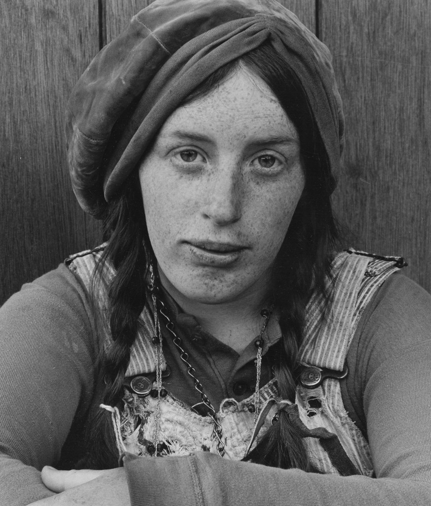 Freckles, Richard Misrach, 1972-74