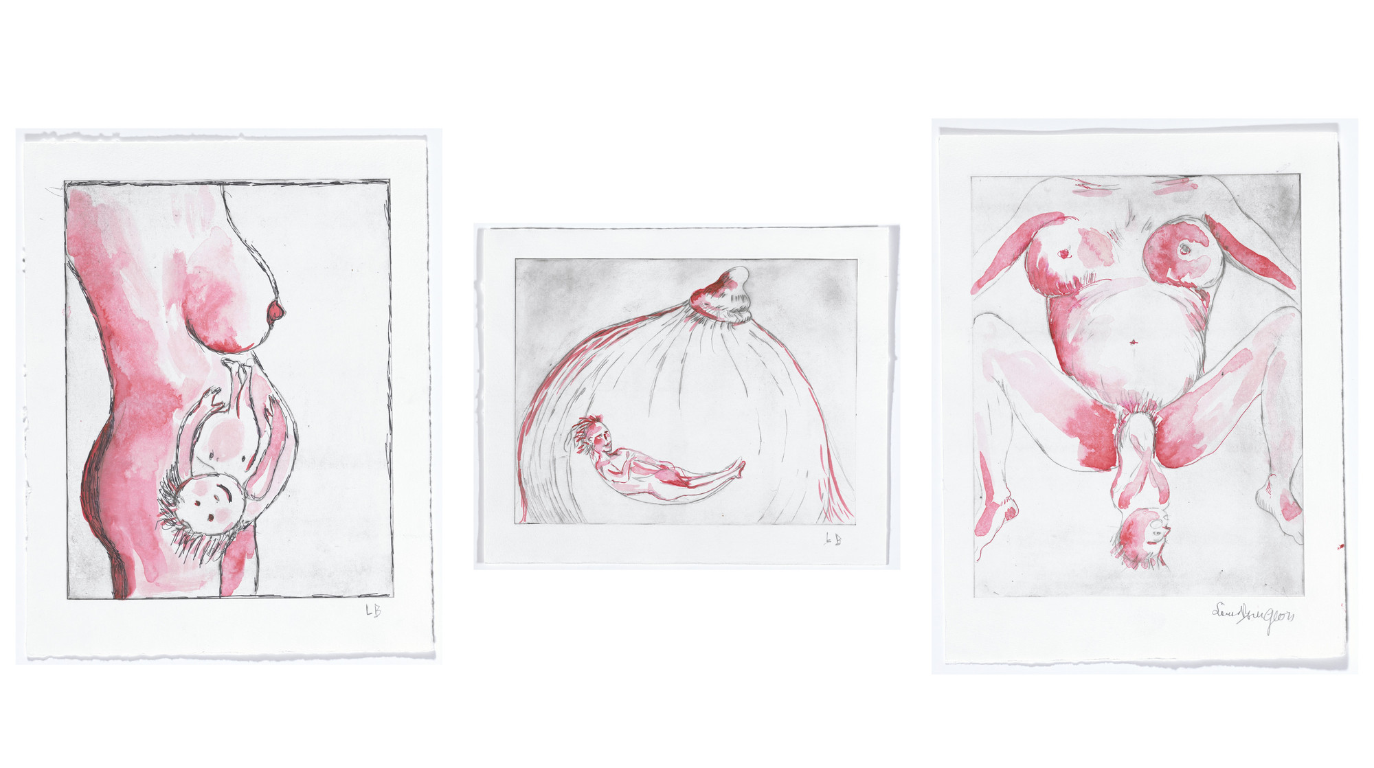 Louise Bourgeois. The Reticent Child, state I of III