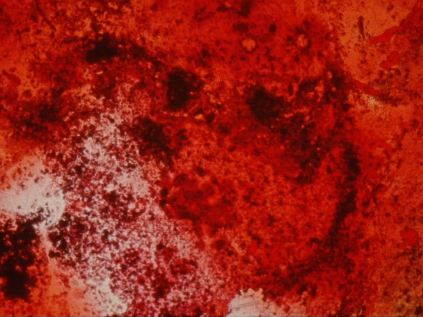 Stan Brakhage. 23rd Psalm Branch, Parts 1 &amp; 2. 1966-67/1978