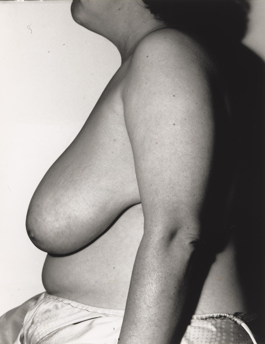 Jo Spence, Terry Dennett. Remodelling Photo History: Victimization. 1981-82