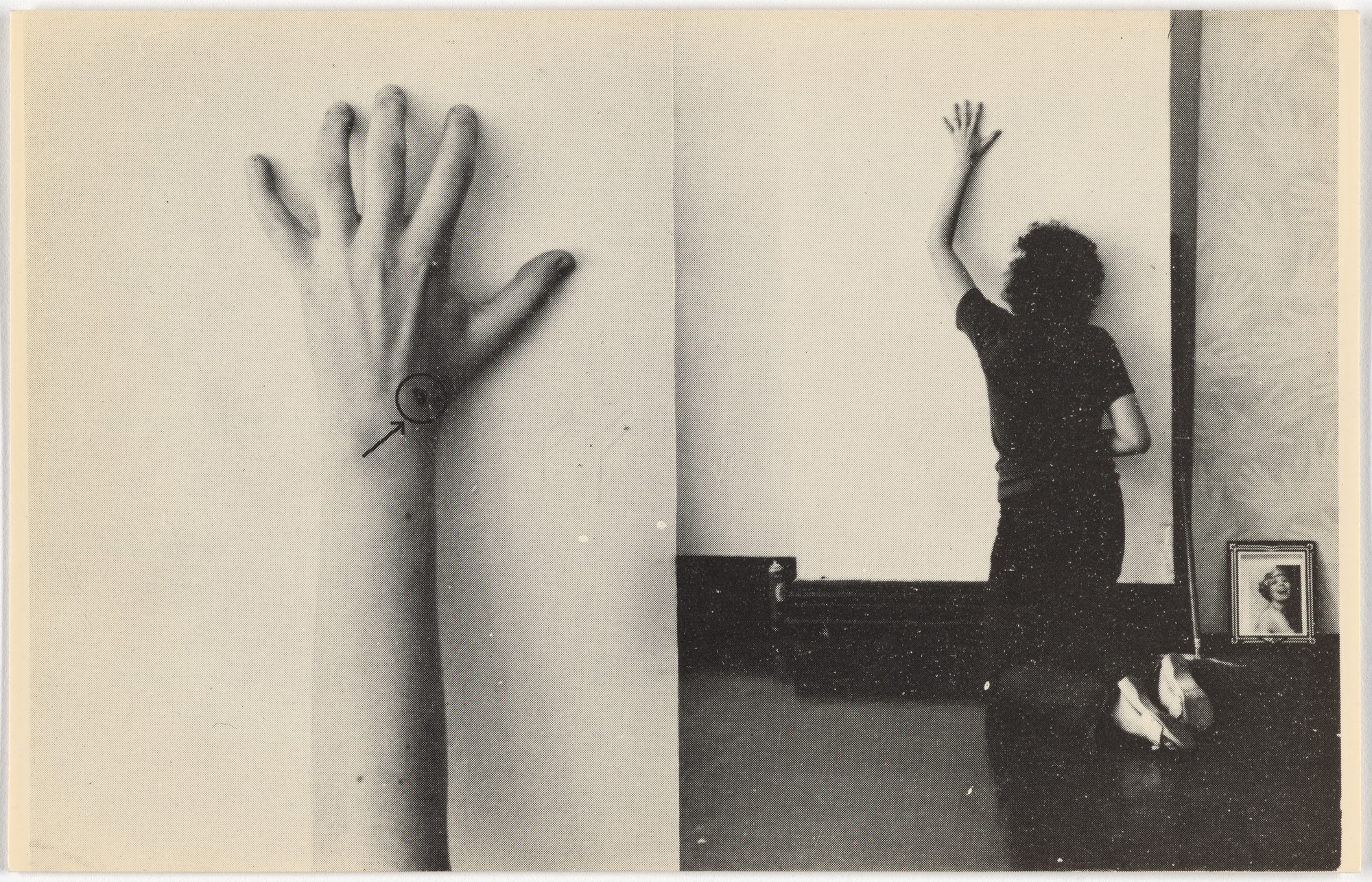 General Idea. CIGARETTE BURN executed by Andy Warhol on Granada Gazelle for General Idea, New York, 1971. 1971