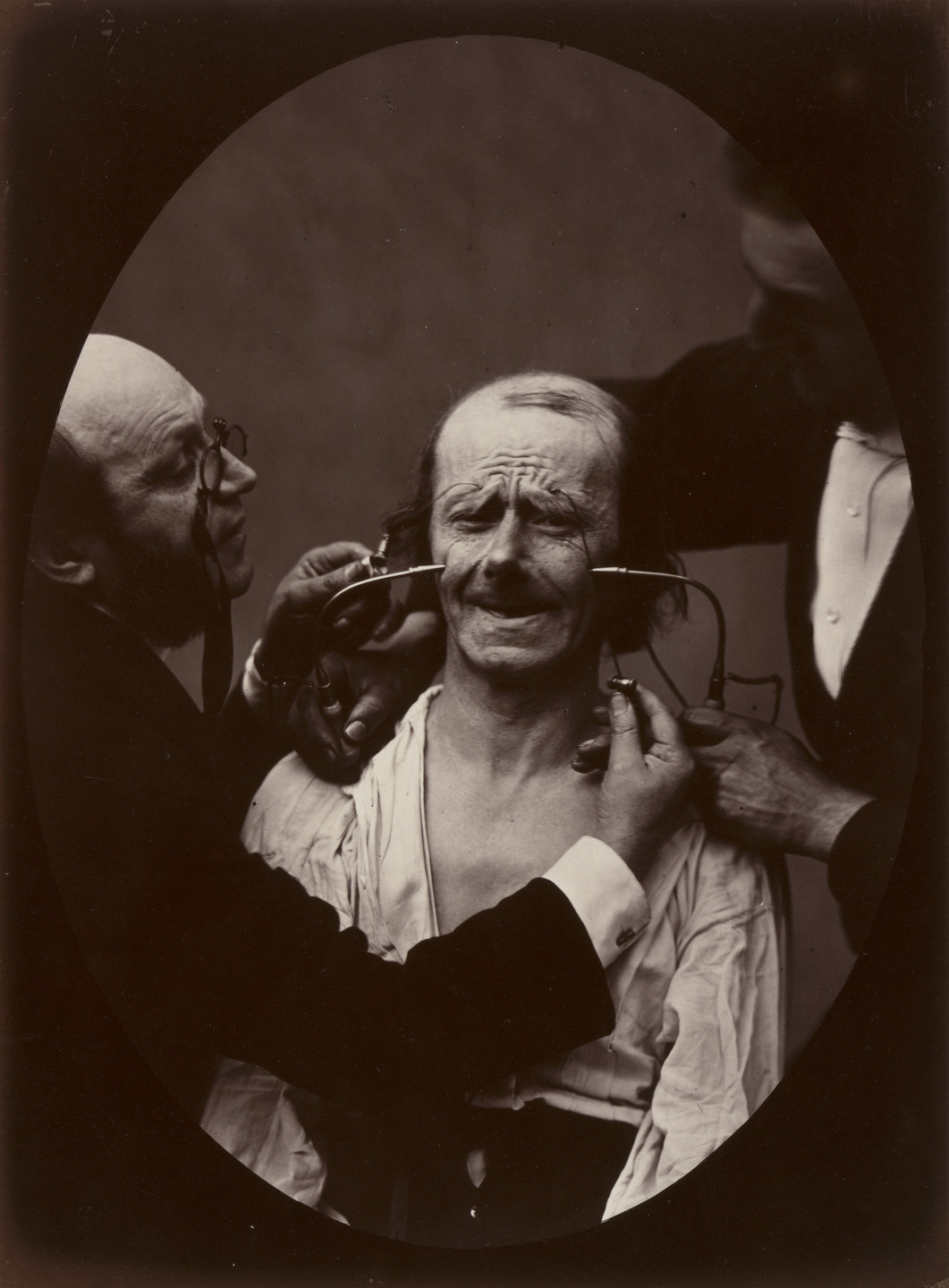 Guillaume-Benjamin-Armand Duchenne de Boulogne, Adrien Tournachon. Plate 34 from the chapter The muscles of Joy and Benevolence. c. 1856
