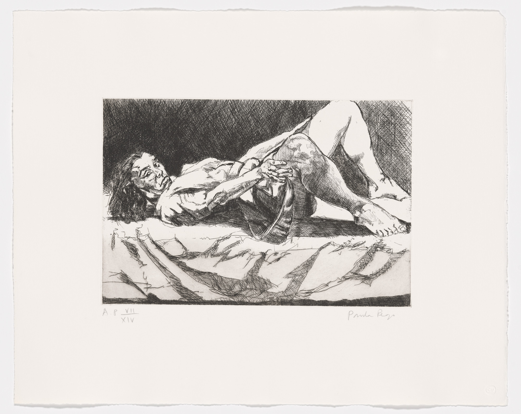 Paula Rego. Untitled 2 from Untitled (The Abortion Series)