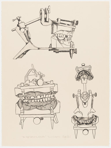 Mr. Huff's Teeth in the Articulator