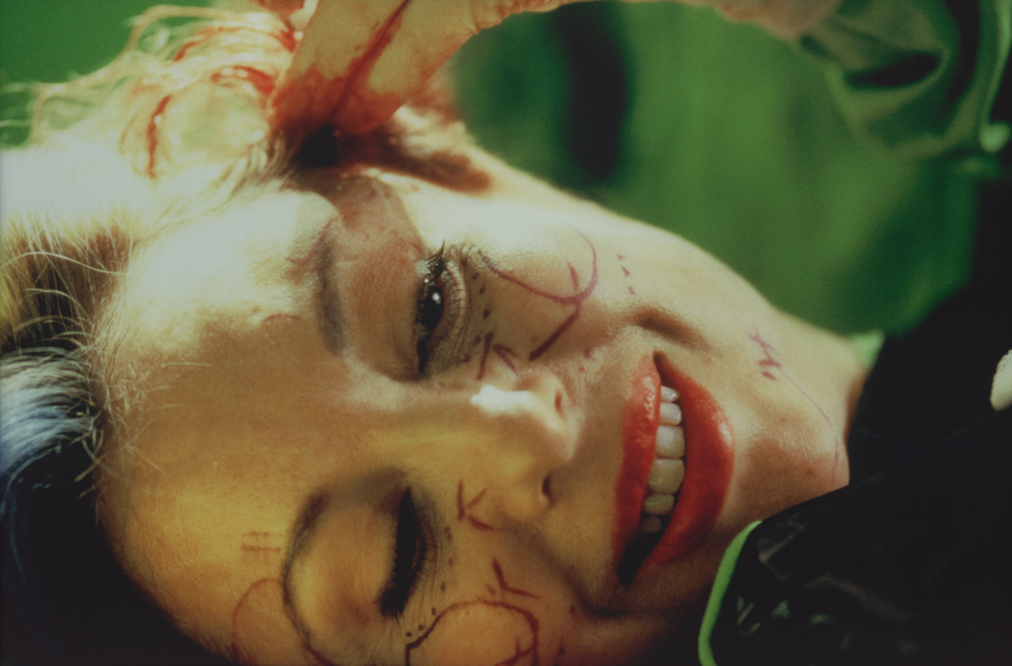 ORLAN (Mirielle Suzanne Francette Porte). Close-up of Laughter during the Operation, New York
