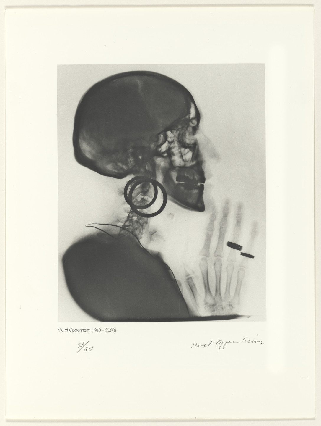 Meret Oppenheim. X-Ray of M.O.’s Skull (Röntgenaufnahme des Schädels M.O.). 1964, printed 1981