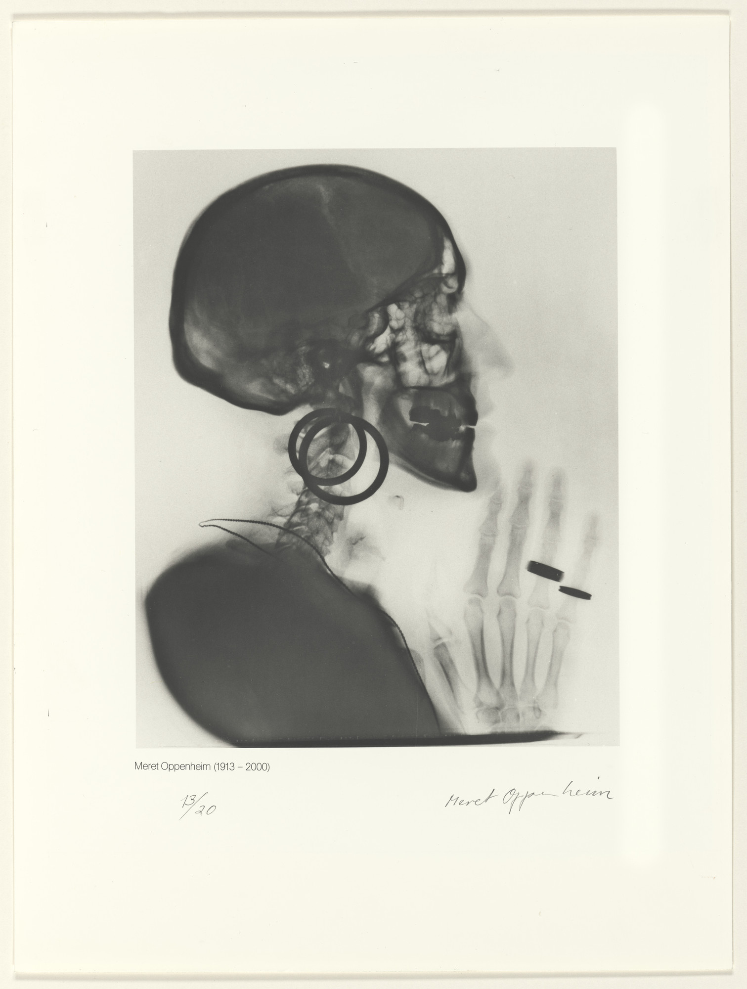 Meret Oppenheim. X-Ray of M.O.'s Skull (Röntgenaufnahme des