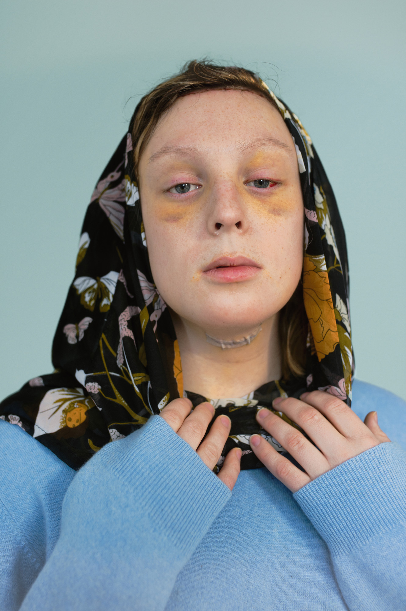 Elle Pérez. Mae (three days after)